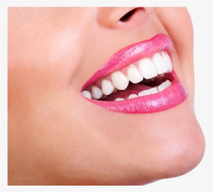 Teeth Whitening Centre London Ontario - Smile Teeth
