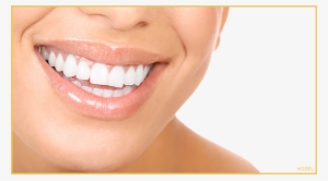 Cosmetic Dentistry In Dubai - Woman Teeth