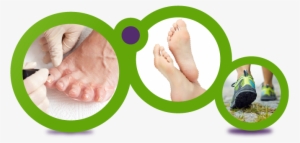 Foot Care - Foot Ulcer Causes