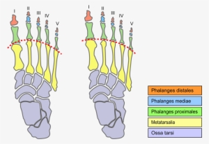 Morton's Foot