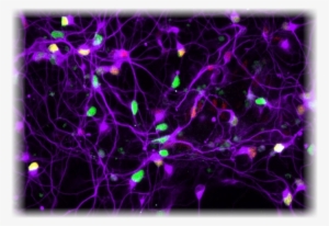 Catalog Of The Ninds Human Cell And Data Repository - Stem Cell