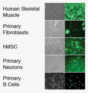High-performance Transfection Of A Variety Of Human - Fibroblast Primary Cell