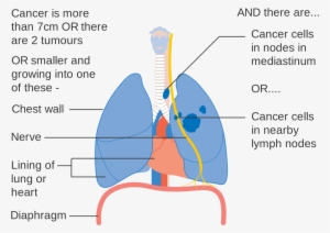 Common Lung Diseases And Their Causes - Side Determination Of Lungs