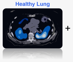 Healthy-lung - Cancer