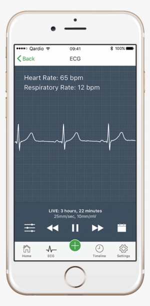 How To Read An Electrocardiogram - Afib Heart Rate Monitor