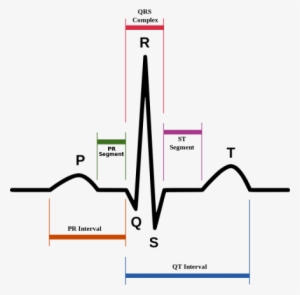 Schematic Representation Of Normal Ecg Trace With Waves, - Qt Interval