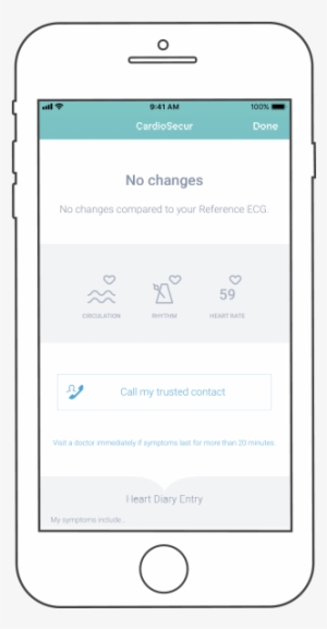 Recommendation To Act - Iphone