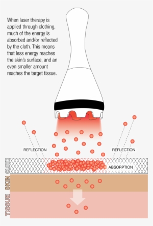 Treating Off Contact Clothing Thin - Diagram