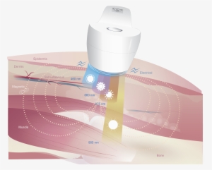 Super Pulsed Laser - Small Appliance
