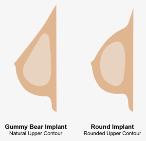 Round And Gummy Bear Implants - Round Vs Teardrop Breast Implant