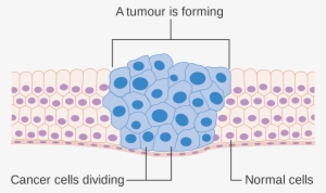 Open - Cancer Cells Diagram