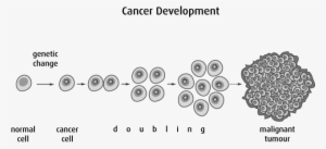 Other Forms Of Cancer Treatment, Such As Chemotherapy - Tumeur Bénigne Et Maligne