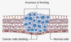 Drugs Used To Target Tumour Cells During Chemotherapy