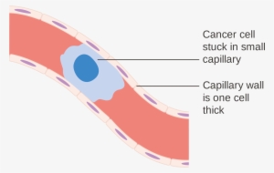 Open - Capillary Cancer