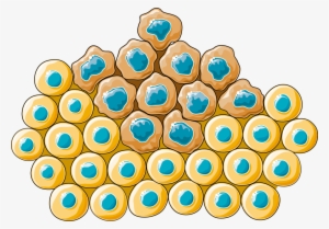 Carcinoma - Cancer Cell Clipart