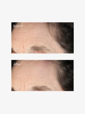 Perricone Md Essential Fx Deep Crease Serum 213119 - Eyelash