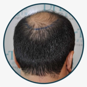 Back - Online And Offline