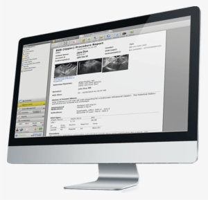 Endoscopy Report Writer On Imac - Computer Monitor