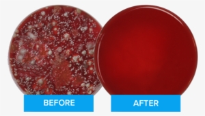 This Image Of The Petri Dishes Shows The Results Of - Phonesoap 3 - Aqua