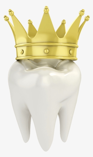 3d Single Tooth With Crown Illustration - Tooth With Crown Png