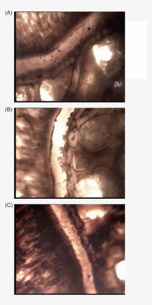 Effect Of Alcohol And Aqueous Extracts Of Young Prop - Medical Imaging