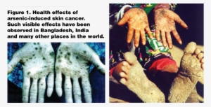 And Lymphatic System As Well As Development Of Lung - Arsenic Used For Today