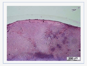 Sem Image Of An Anterior Lens Capsule Following Low - Lilac