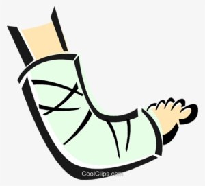 Broken Arm In A Cast Royalty Free Vector Clip Art Illustration - Broken Arm Clip Art