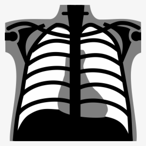 Open Chest Vector - 450x420 PNG Download - PNGkit