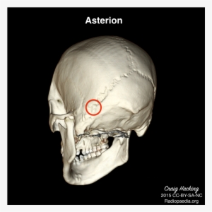 Version Of Skull Landmarks Images - Asterion On The Skull