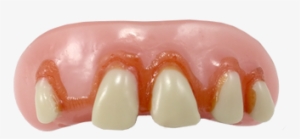 Betty Bob Billy Bob Teeth - Cosmetics