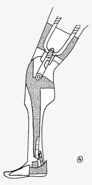 Prosthetics Extra Josh Parkin4 Salem Leg - Handgun