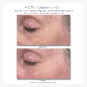 Download - Neostrata Spot Lightening Results