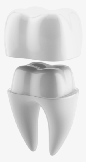 Illustrated Diagram Of Tooth Getting A Crown Cap - 3d Print Dental Crown