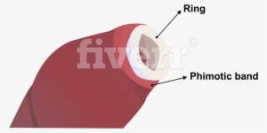 Digitally Draw Anatomy Diagrams And Medical Illustrations - Fiverr