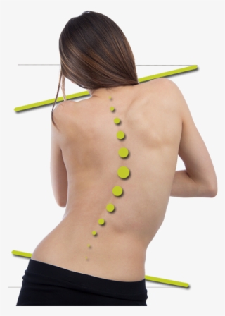 One Hip Appears Lower Than The Other - Signos De La Escoliosis En Niños