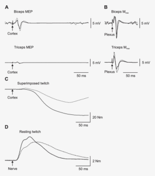 Average Traces Of Emg And Torque Responses To Stimulation - Compound Muscle Action Potential