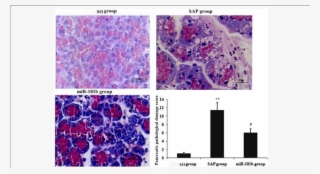 Effects Of Overexpression Of Mir-181b On Pancreas Damage - Common Fig
