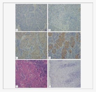 Immunohistochemistry Analysis Of Mtor Expression In - Tile