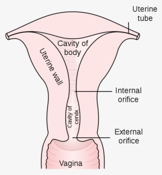 These Tumors Also Interfere With The Natural Ability - Uterus Cervical Canal