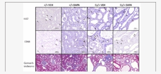 Histological Analysis For Ki67, Cd68 And Interstitial - Cd68