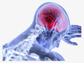 Upper Hill, Pa Three Injured In Two-vehicle Crash At - Cianuro Sintomas De Intoxicacion