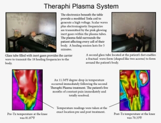 Theraphi Plasma Unit123 - Blood Plasma