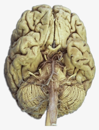 Anatomy Of Real Brain Cranial Nerves Quiz At Bes On - Nervios Craneales Anatomia