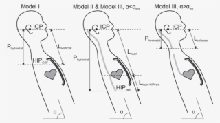 Illustration Of The Three Models Of The Effect Of Posture - Drawing
