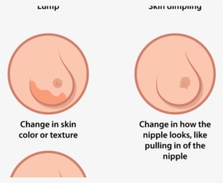 Breast Cancer Is A Woman's Greatest Fear, But Also - Play Button Icon