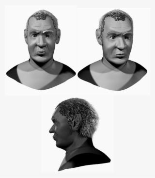 Frontal, Sagittal And 3/4 View Of Virtual Reconstruction - Sagittal Plane