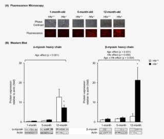 Effect Of Age On The Expression Of Cardiac Myosin Heavy - Diagram