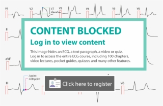 Ecg Leads Lead Placement Limb Chest Precordial - T Wave