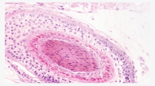 Hair Follicle Cross Section - Close-up